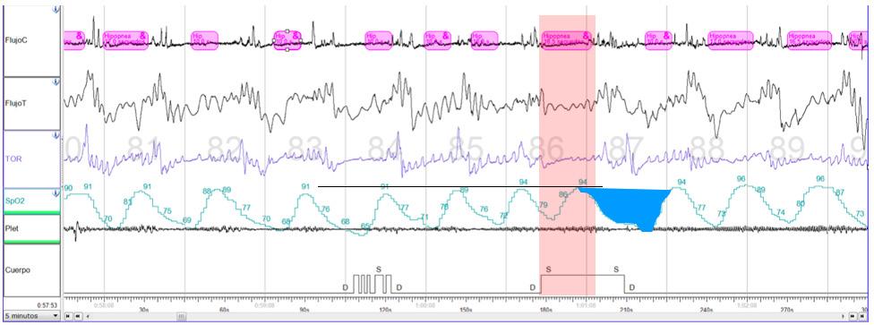 Gráficas Corona JE, S.A. De C.V.